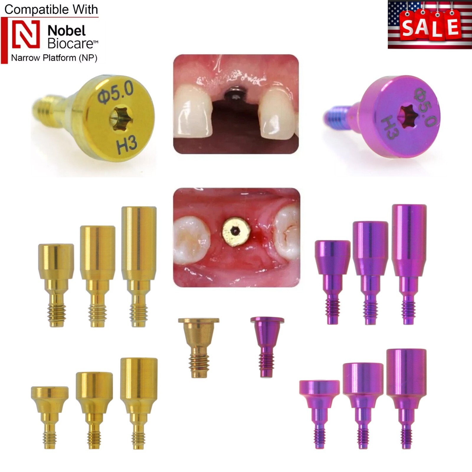 NobelActive Dental Healing Abutment Cap Fit Nobel Biocare Height 3/5/7mm RP NP