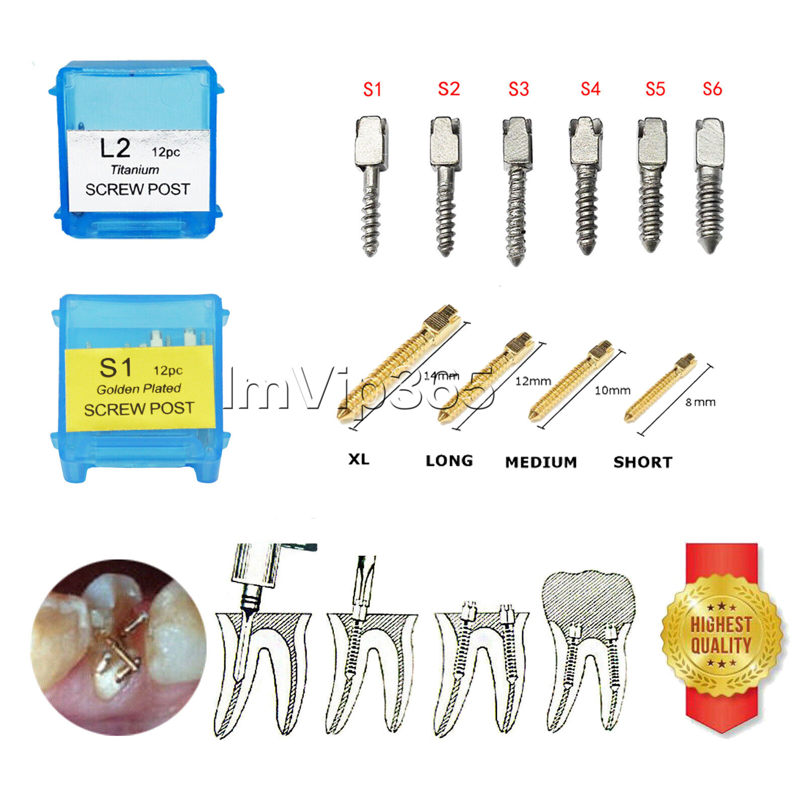 Dental NORDIN Style Endo 24K Golden Plated/Pure TITANIUM Root Canal Screw Post