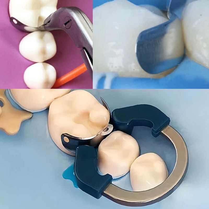 Dental Sectional Matrix System Matrix Bands Clamp Ring Palodent V3 Tulwar Wedges