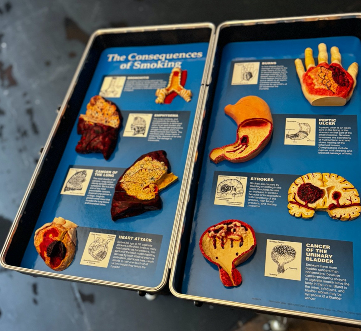 Vintage Health Edco Effects of Alcohol, Smoking, STD’s educational kit