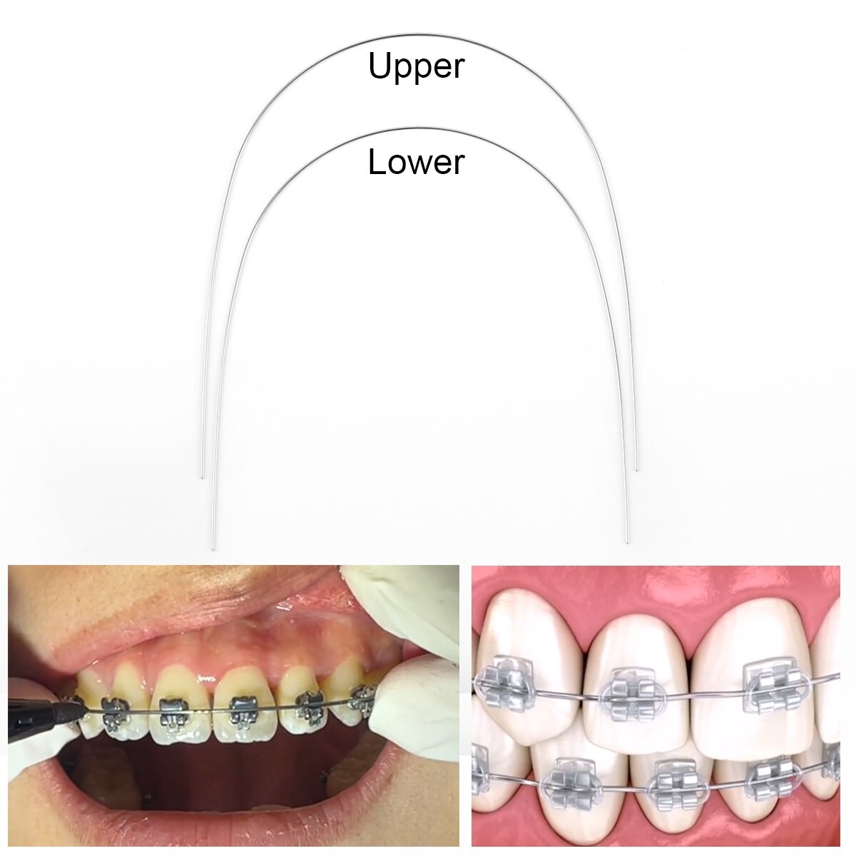 AZDENT Dental Ortho Metal Braces Brackets Mini Roth.022 Hook345/Arch Wire Nature