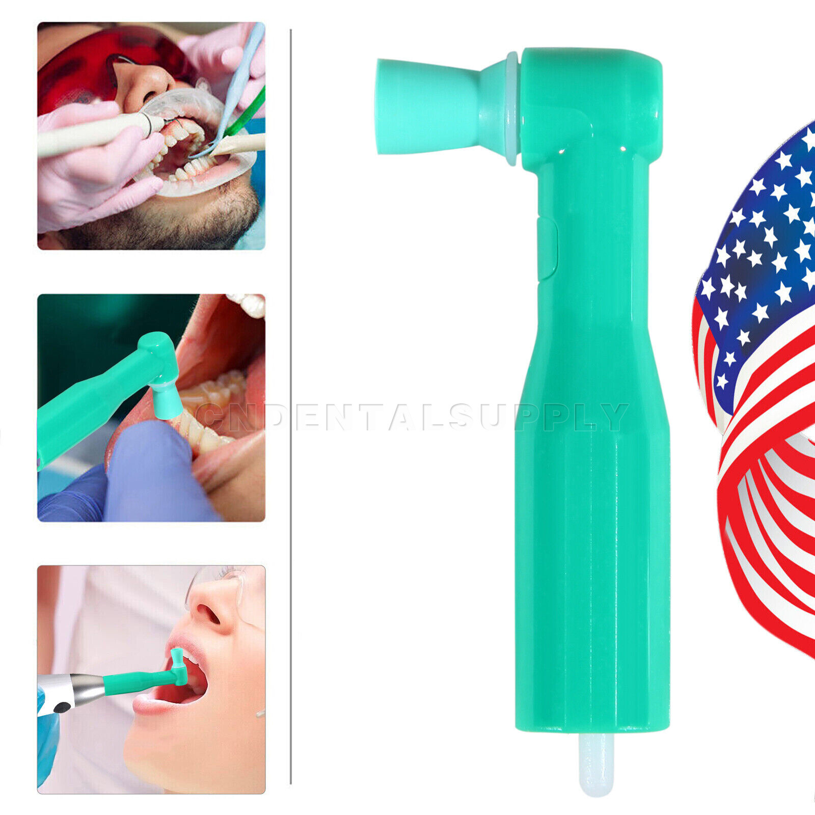 Prophy Angles Soft Cup Designed for Comfort and Splatter Control