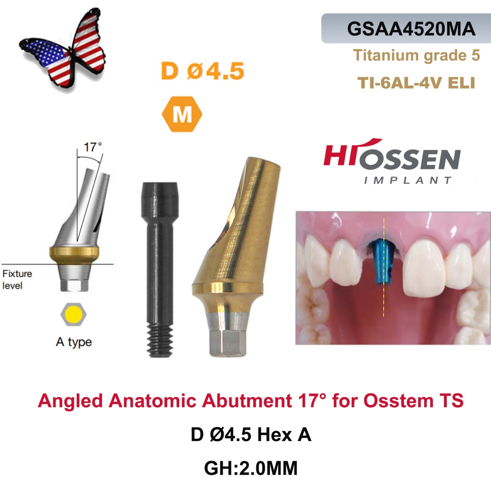 17° Dental Angulated Anatomic Abutment Fit Hiossen ET / Osstem TS Mini & Regular