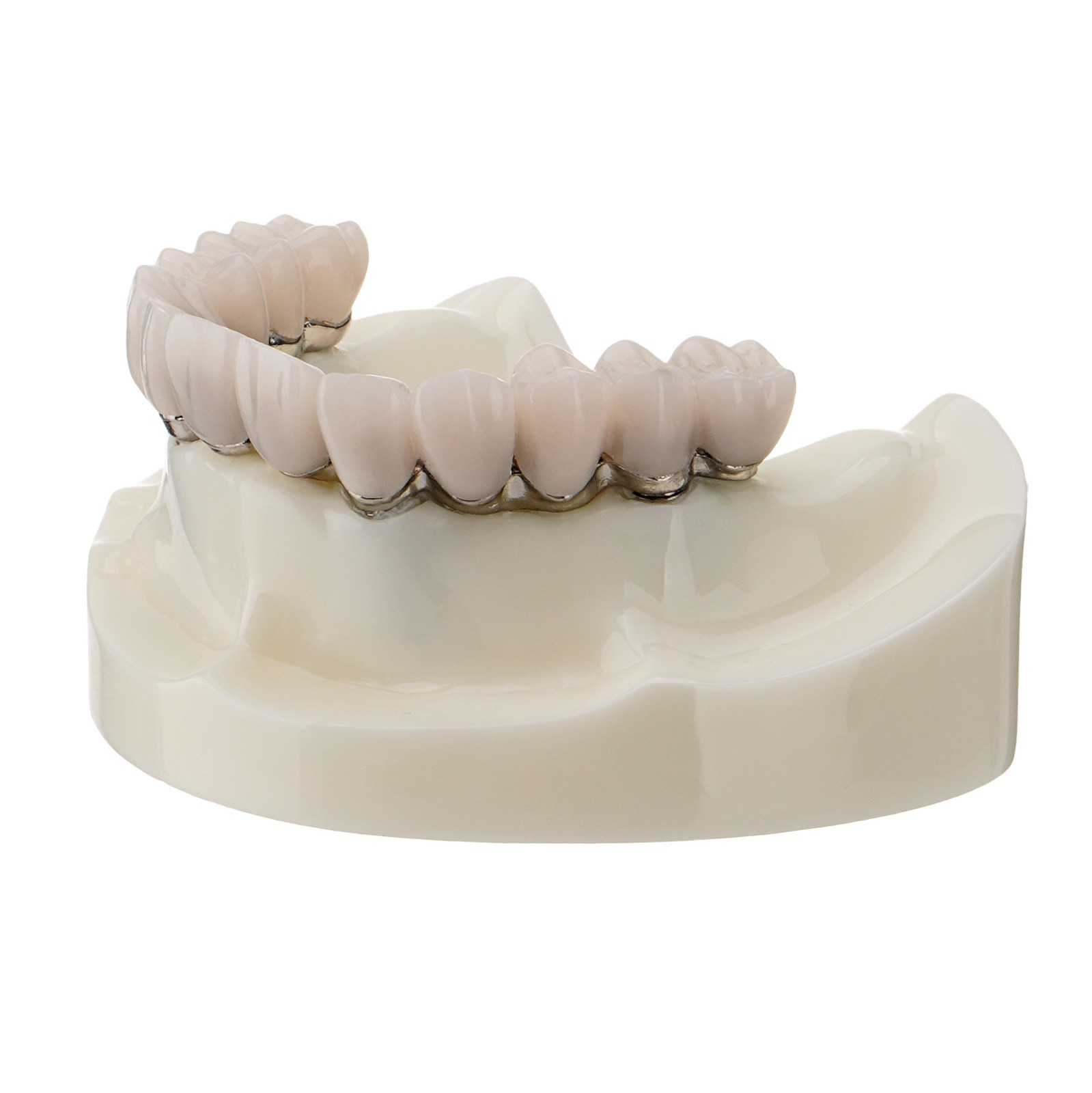 Dental Implant Model Implant Restoration M6023 Upper Jaw All-on-4 Overdenture US