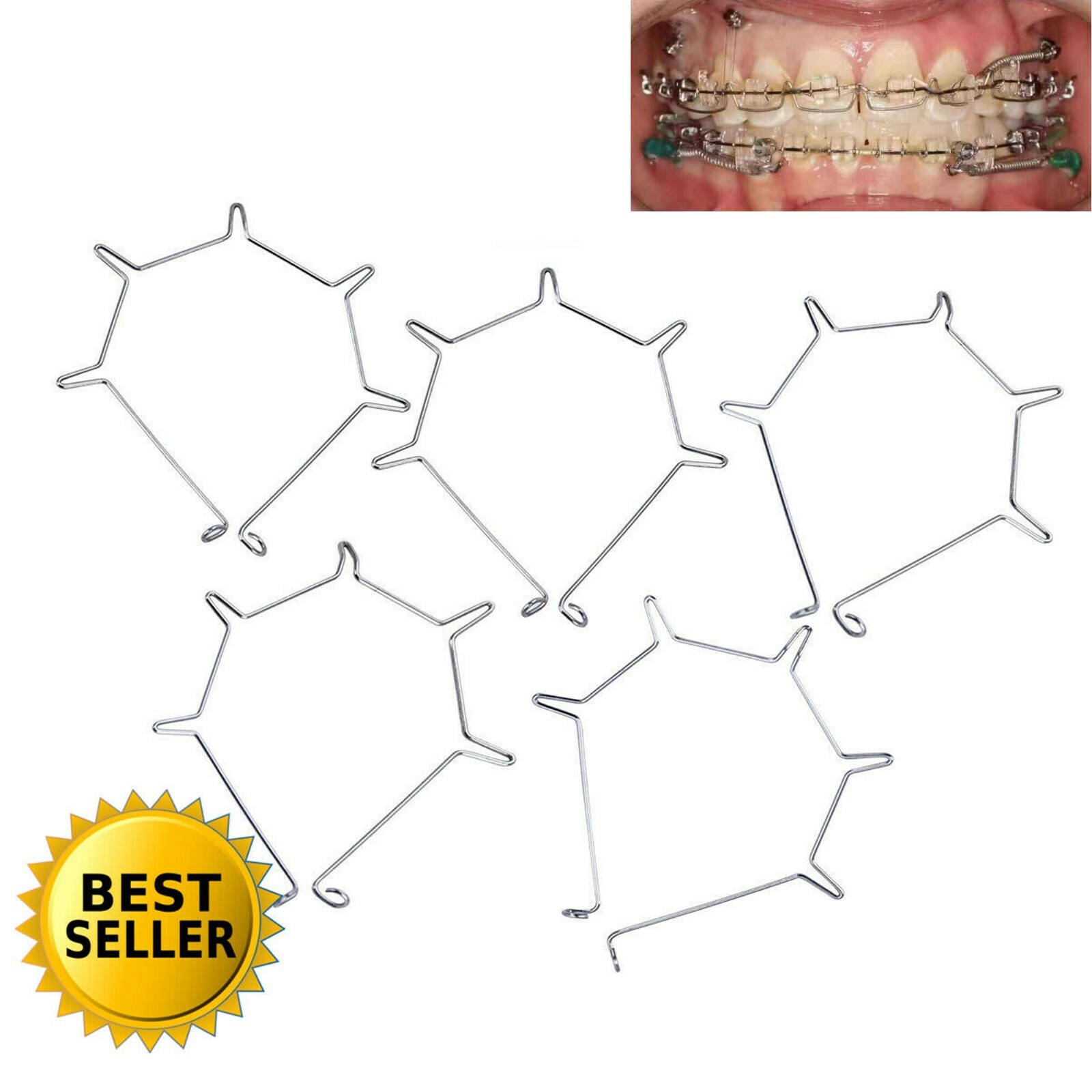 Dental Orthodontic Anterior Root Torque Auxiliary Arch Large Medium Small Lower