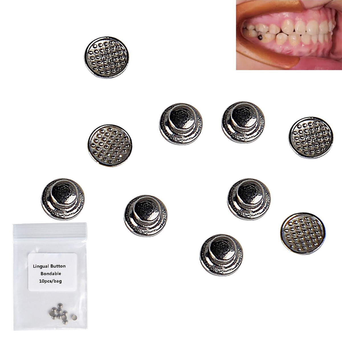 10pcs AZDENT Dental Orthodontic Lingual Buttons Bondable Round Monoblock Metal
