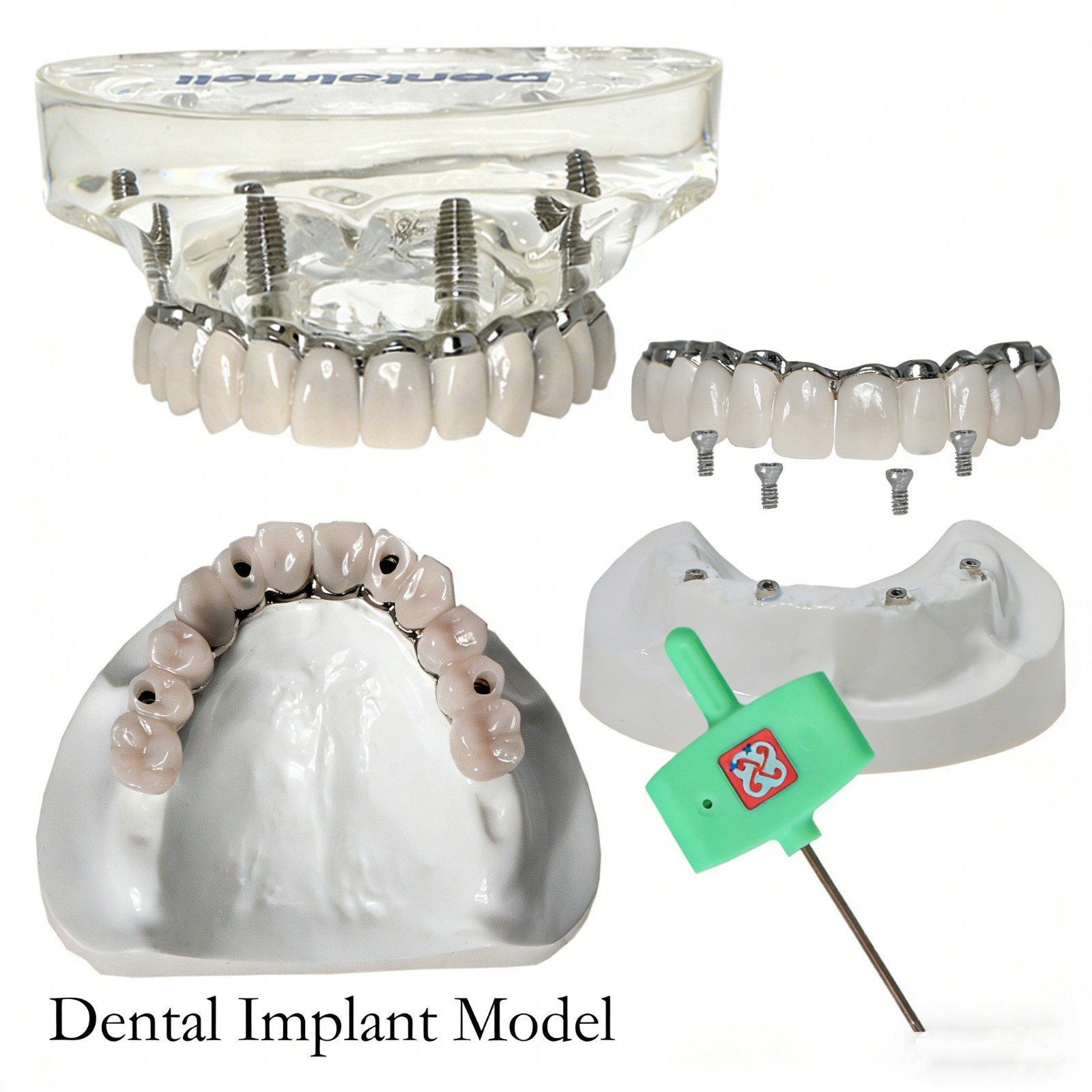 Demo Overdenture All On 4/All On 6 Treatment Dental Implant Model 4/6 Screws Lab