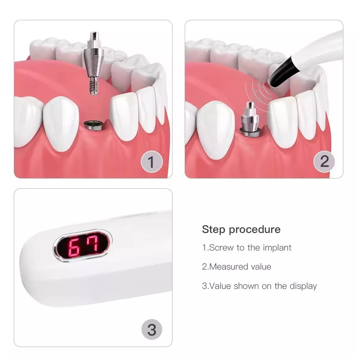 DENTAL ISQ OSSEOINTEGRATION IMPLANT STABILITY MEASUREMENT SYSTEM po