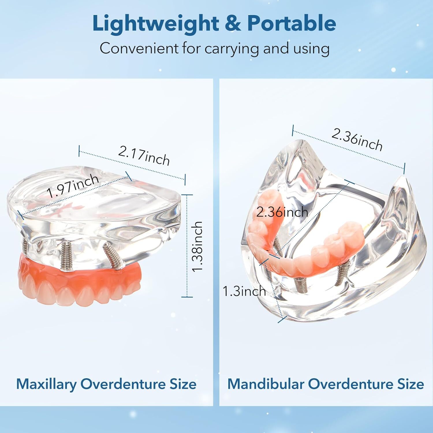 All-on-4 Dental Implants Model with Transparent Base and Removable Crown