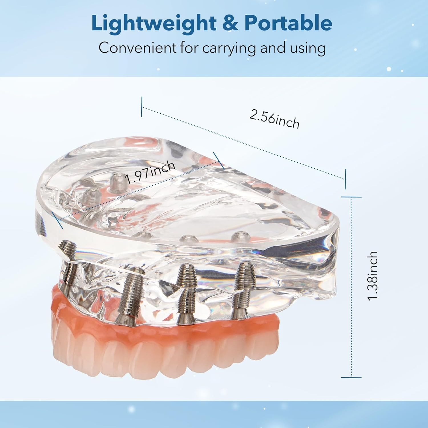 US Dental Implant Model All-on-4 All-on-6 Overdenture U/L Jaw 4/6 Screws Clear