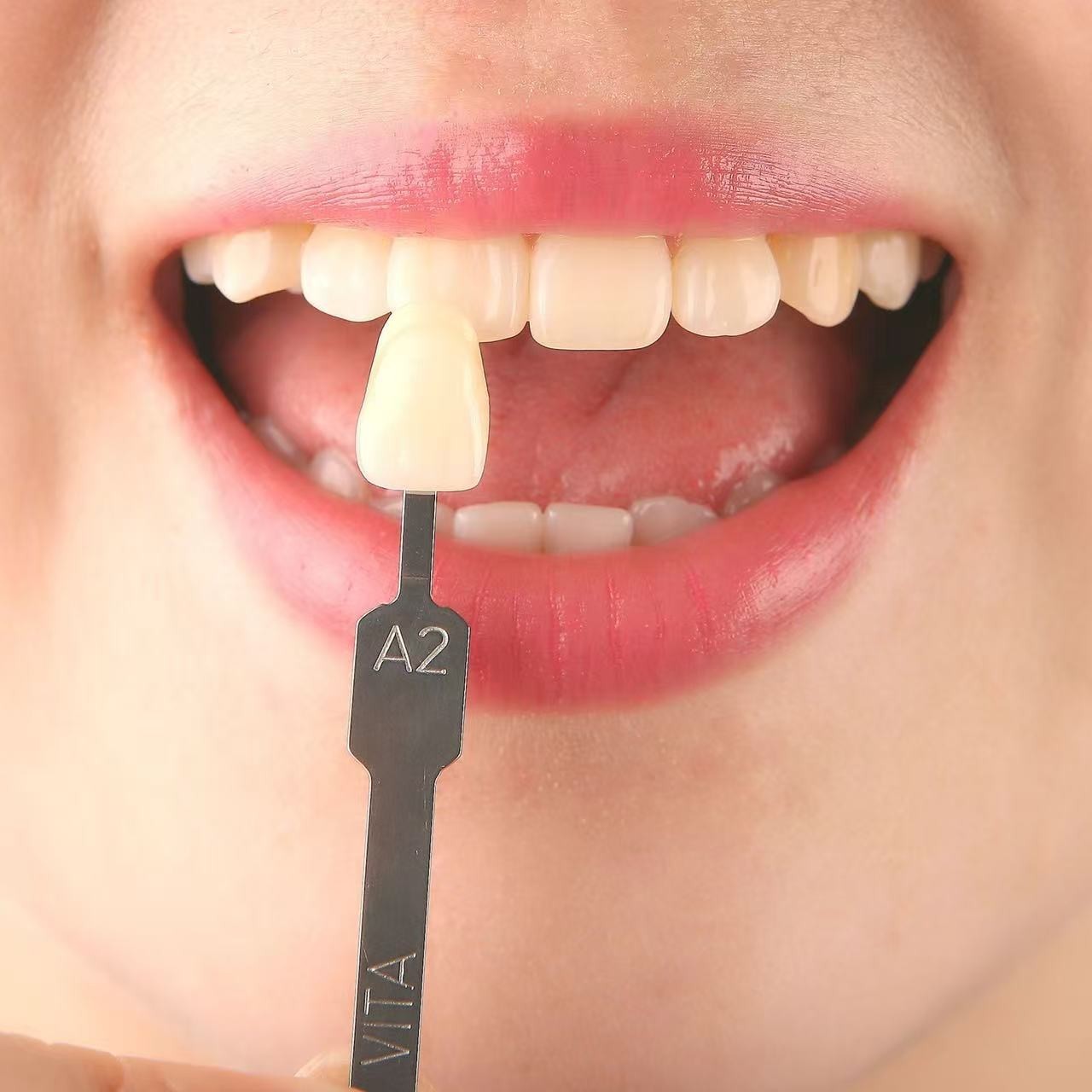NEW VITA Classical Shade Guide 3D Master 29 Natural Tooth Colors Comparison