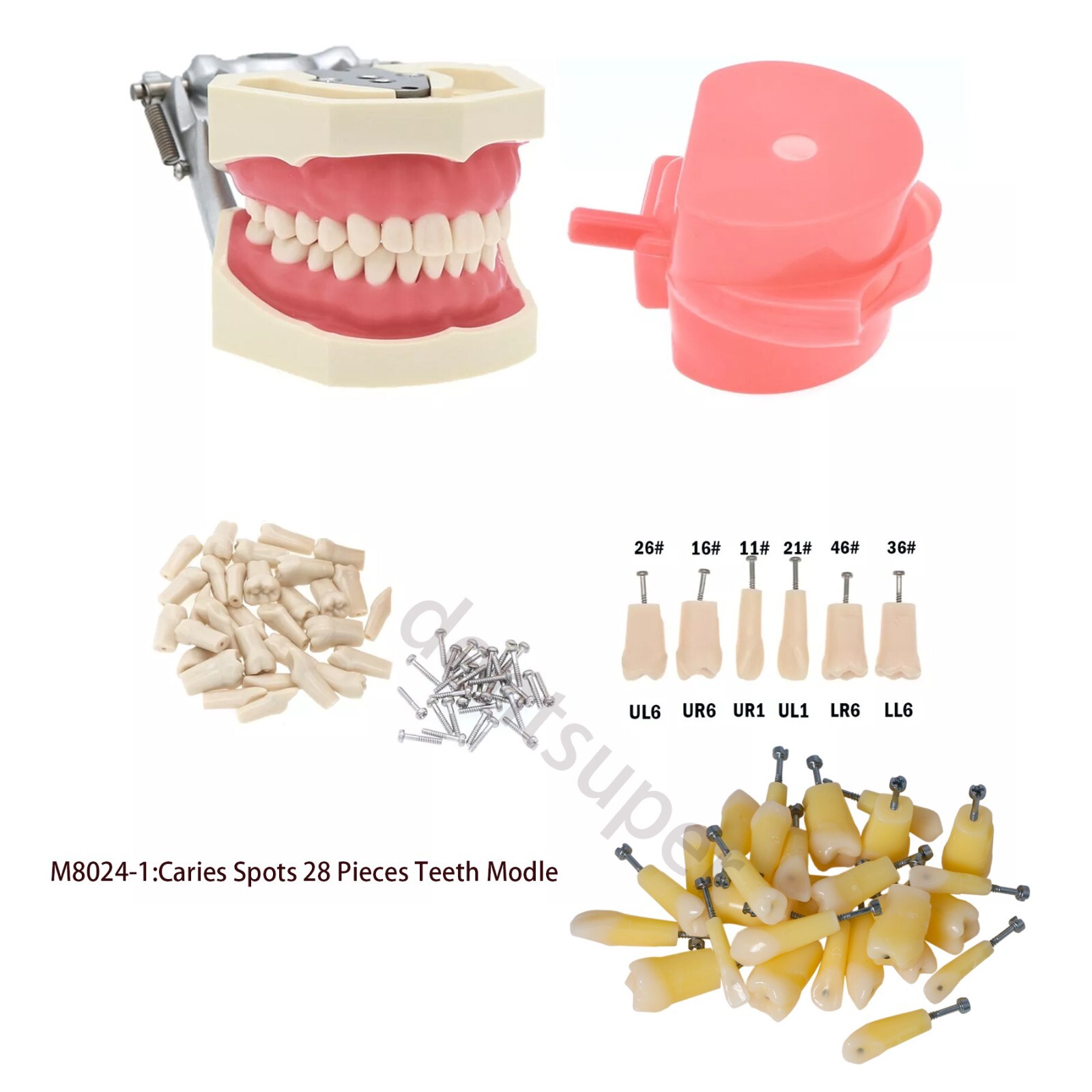 Dental 28 Pieces 200 Typodont Teeth Model with Caries Spots Fits Kilgore Nissin