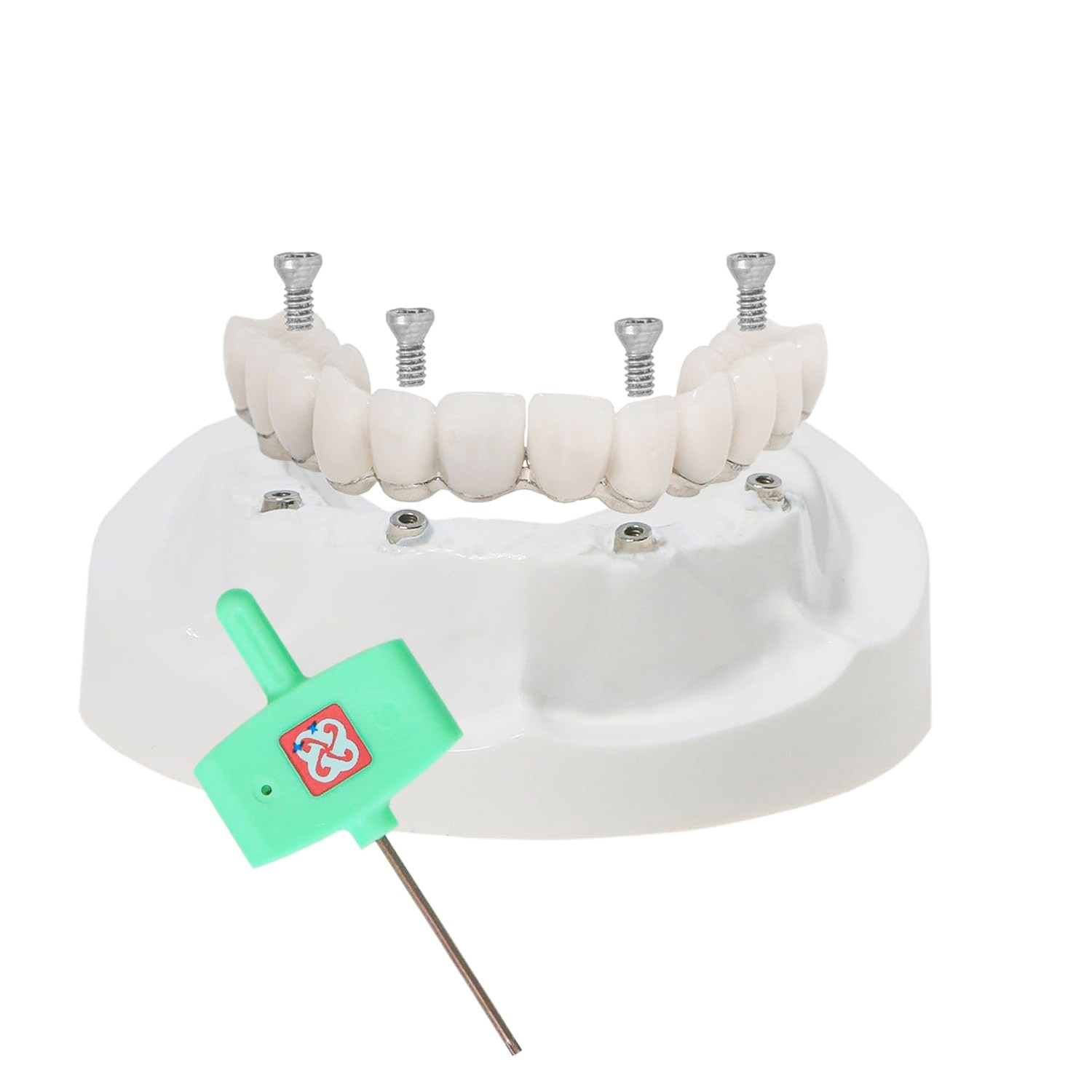 US Dental Implant Model All-on-4 All-on-6 Overdenture U/L Jaw 4/6 Screws Clear