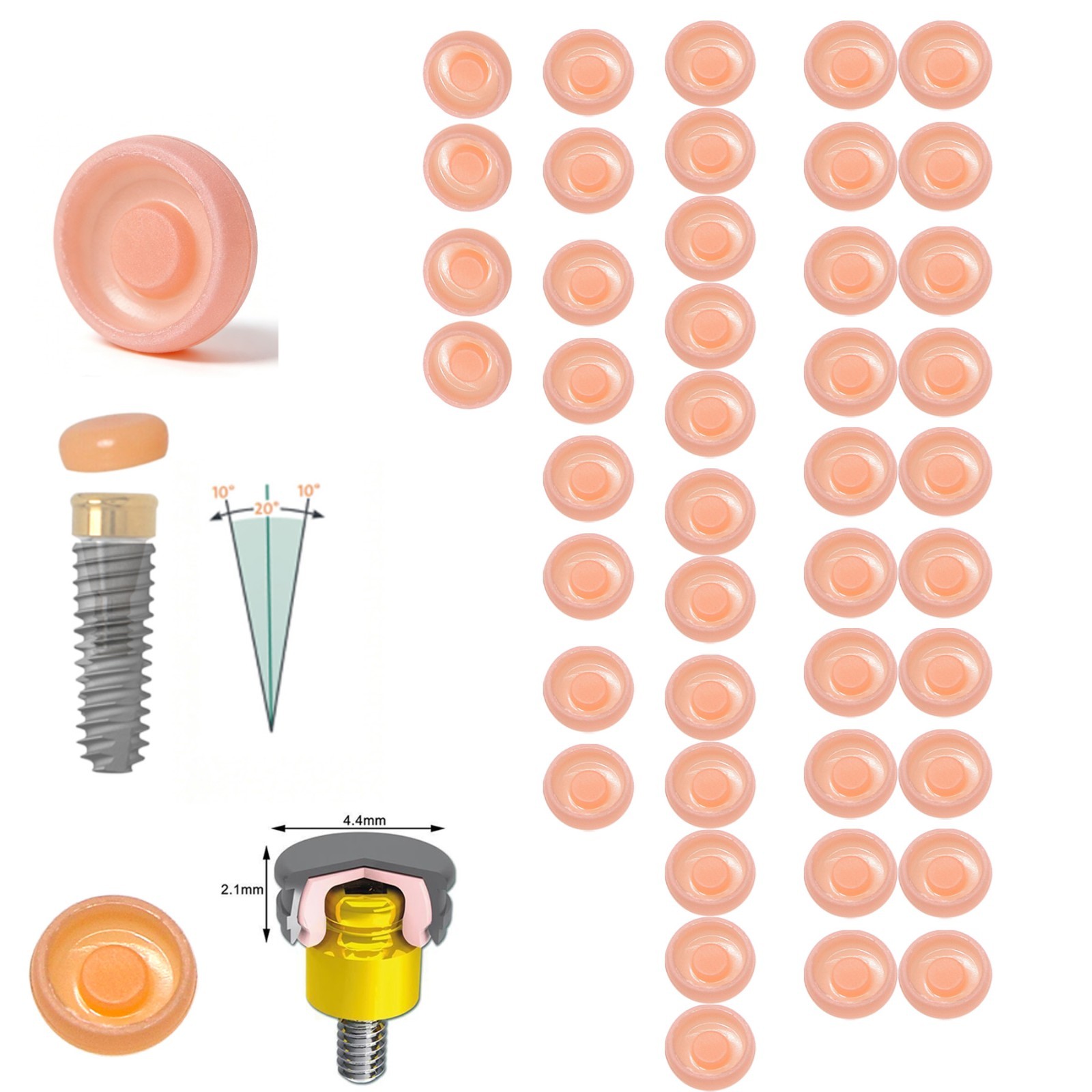 Dental Locator Classic Pink Standard Male Insert 2.4 lbs Light Retention Cap Set