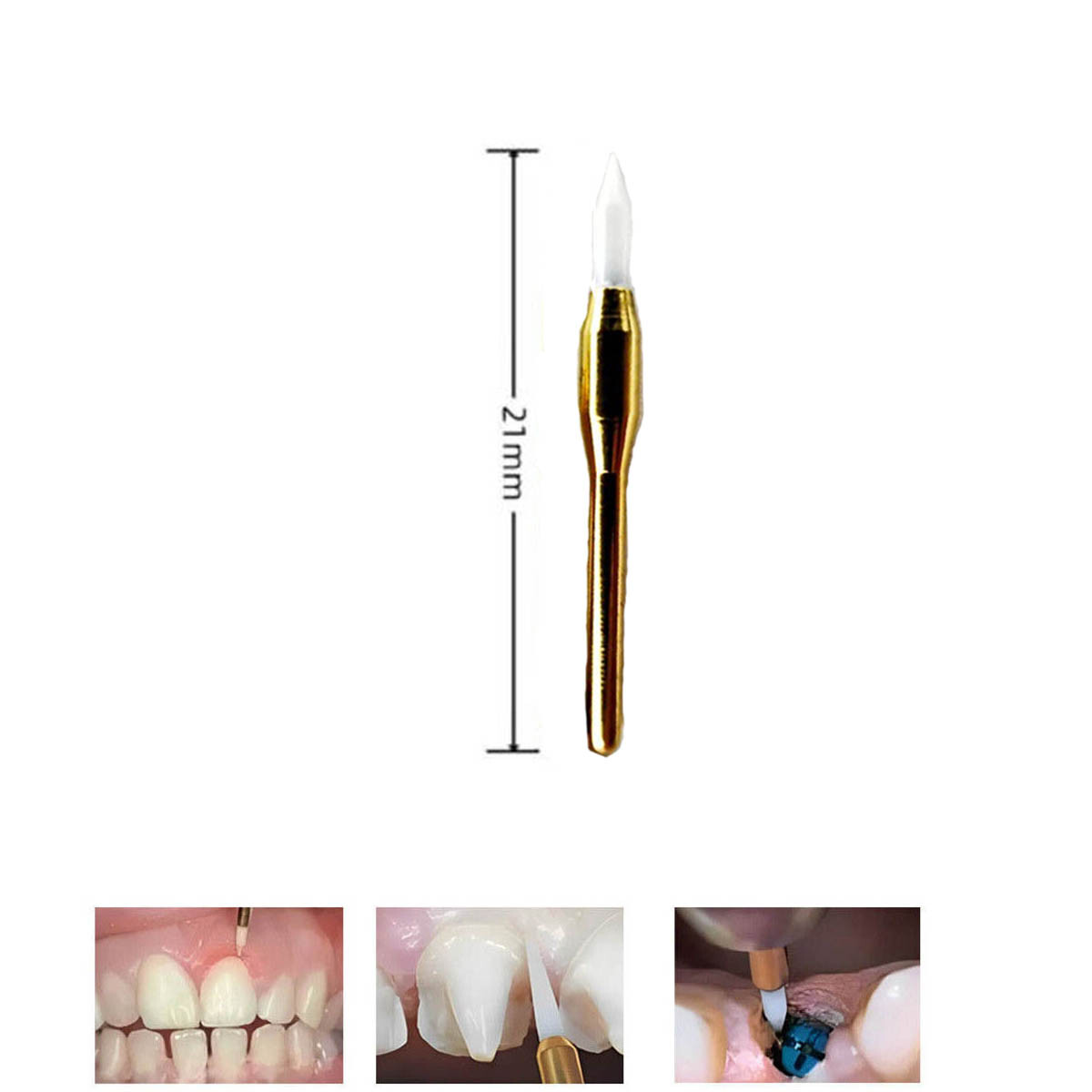 Dental Surgical Ceramic Soft Tissue Trimmer Burs FG 21mm for Gingival Retraction