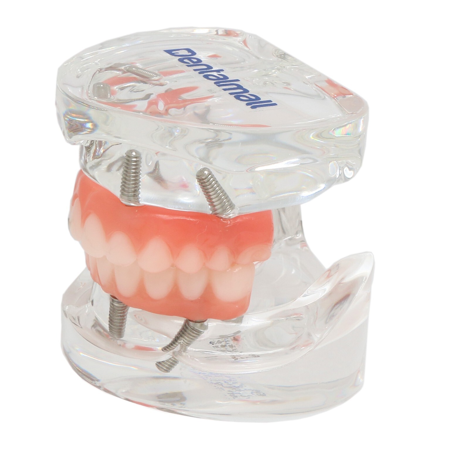 US Dental Implant Model All-on-4 All-on-6 Overdenture U/L Jaw 4/6 Screws Clear