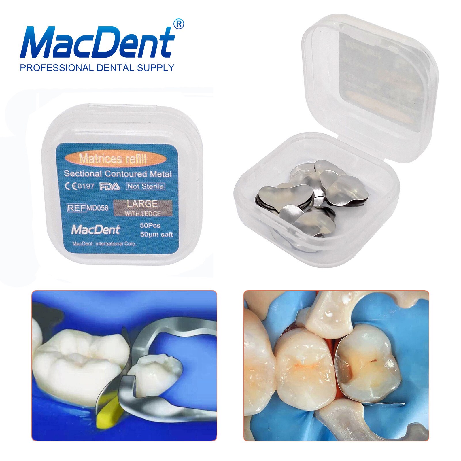 50Pcs/box MacDent Dental Sectional Contoured Matrices Matrix Bands Refill S/M/L