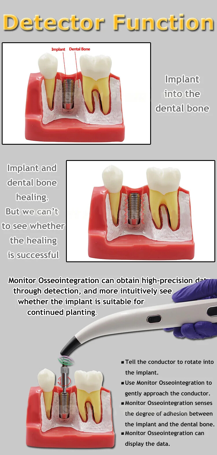 DENTAL NEW ISQ IMPLANT STABILITY METER FAST SHIPPING