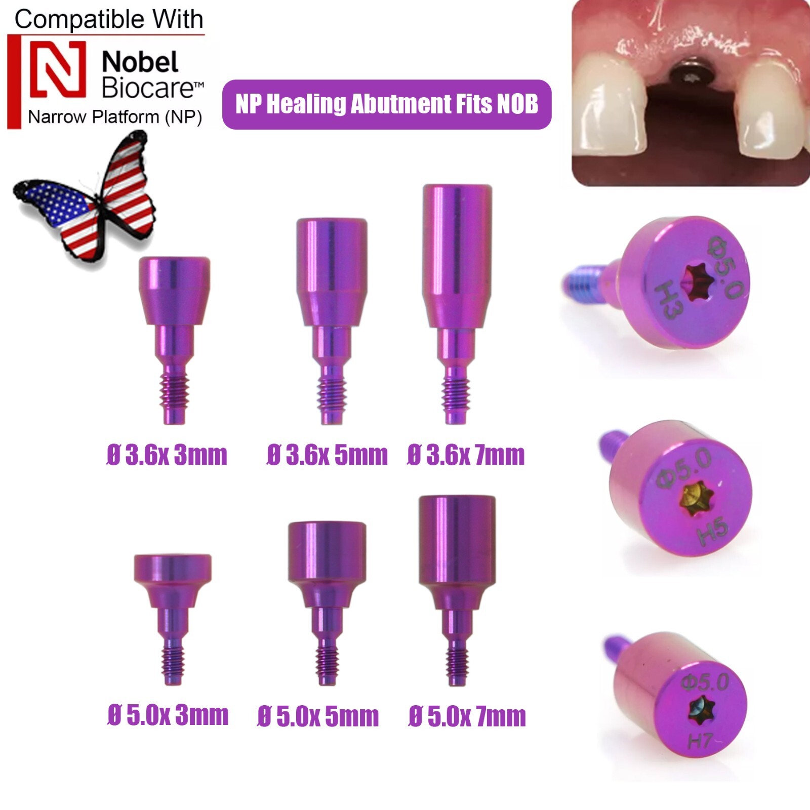 NobelActive Dental Healing Abutment Cap Fit Nobel Biocare Height 3/5/7mm RP NP