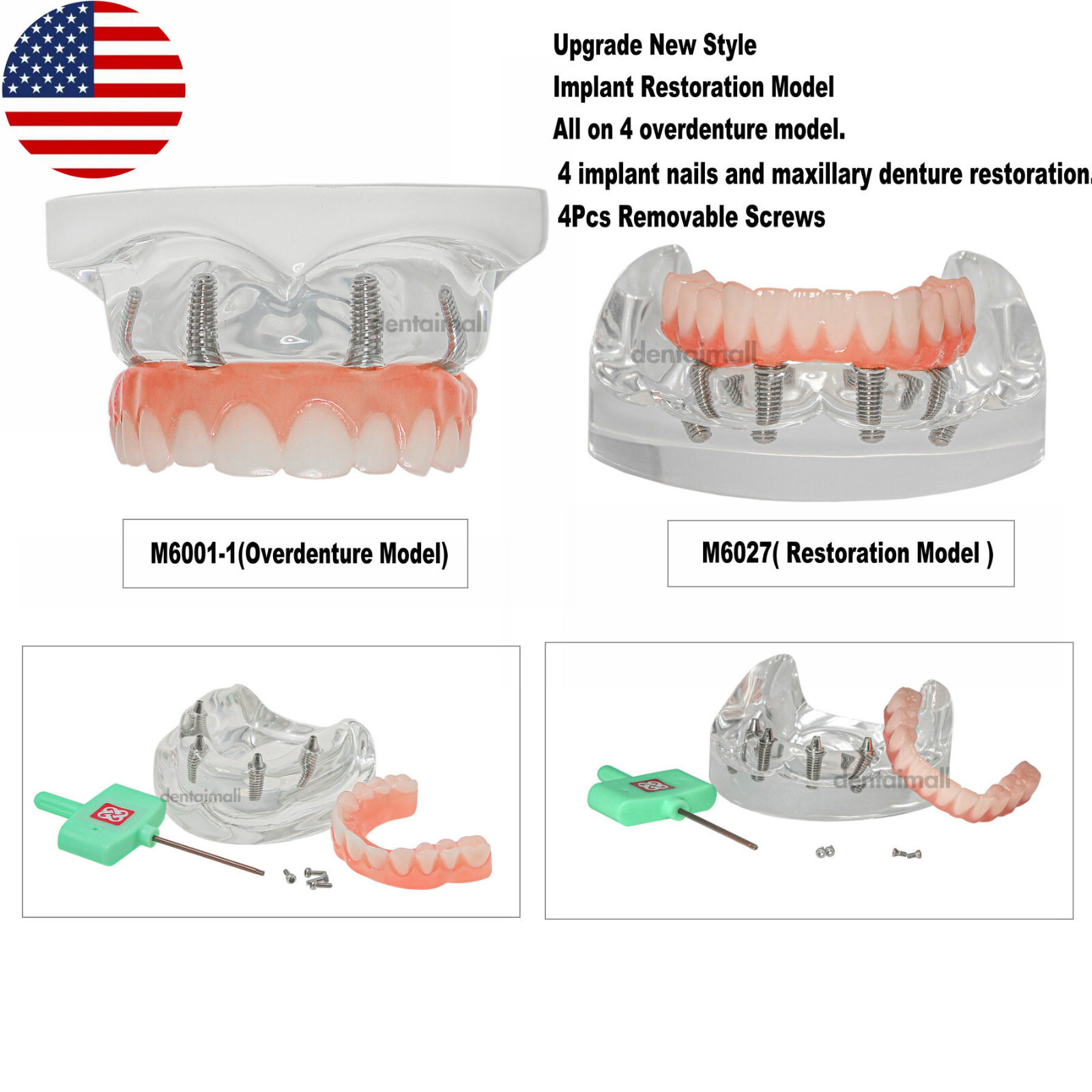 US Dental 4 Screws Overdenture Model All on 4 Restoration Upper/Lower Jaw Type