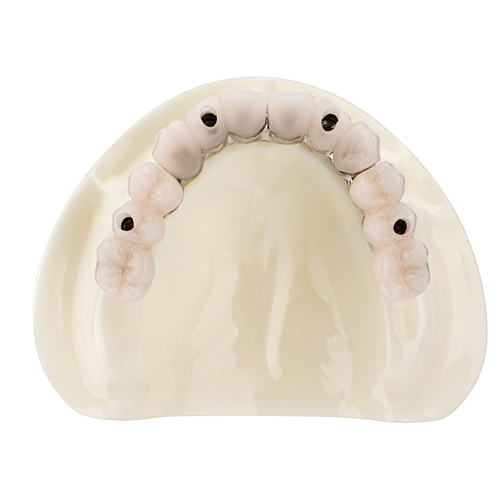 US Dental Implant Model All-on-4 All-on-6 Overdenture U/L Jaw 4/6 Screws Clear