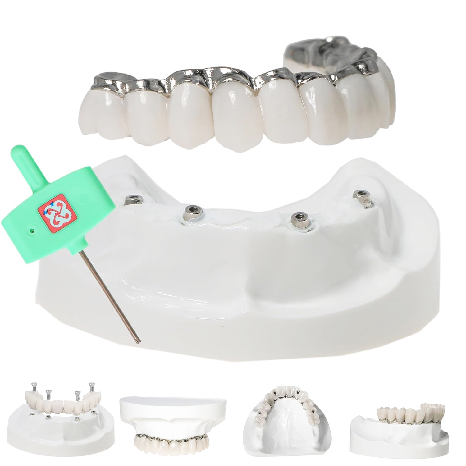 US Dental Implant Model All-on-4 All-on-6 Overdenture U/L Jaw 4/6 Screws Clear