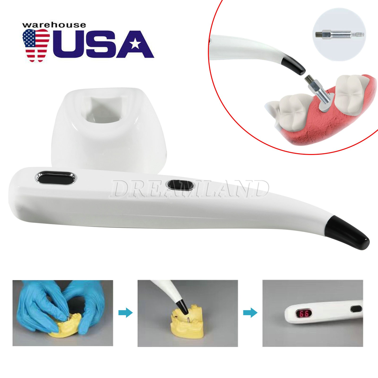 Dental Implant Osseointegration Monitor Stability Measurement Tester Devices ISQ