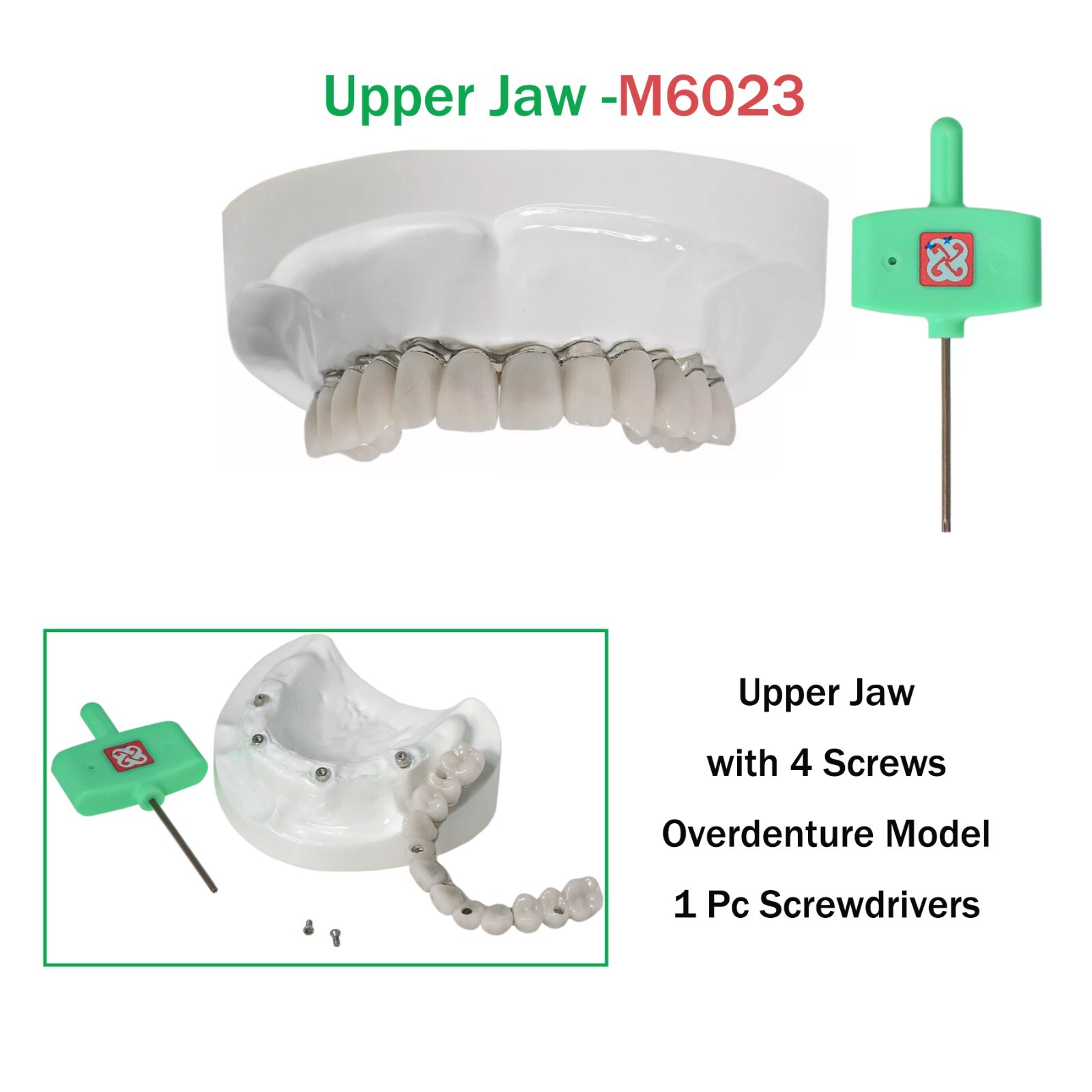 Implants Dental All-on-4 Overdenture Model Upper Jaw Restoration 4 Screws M6023