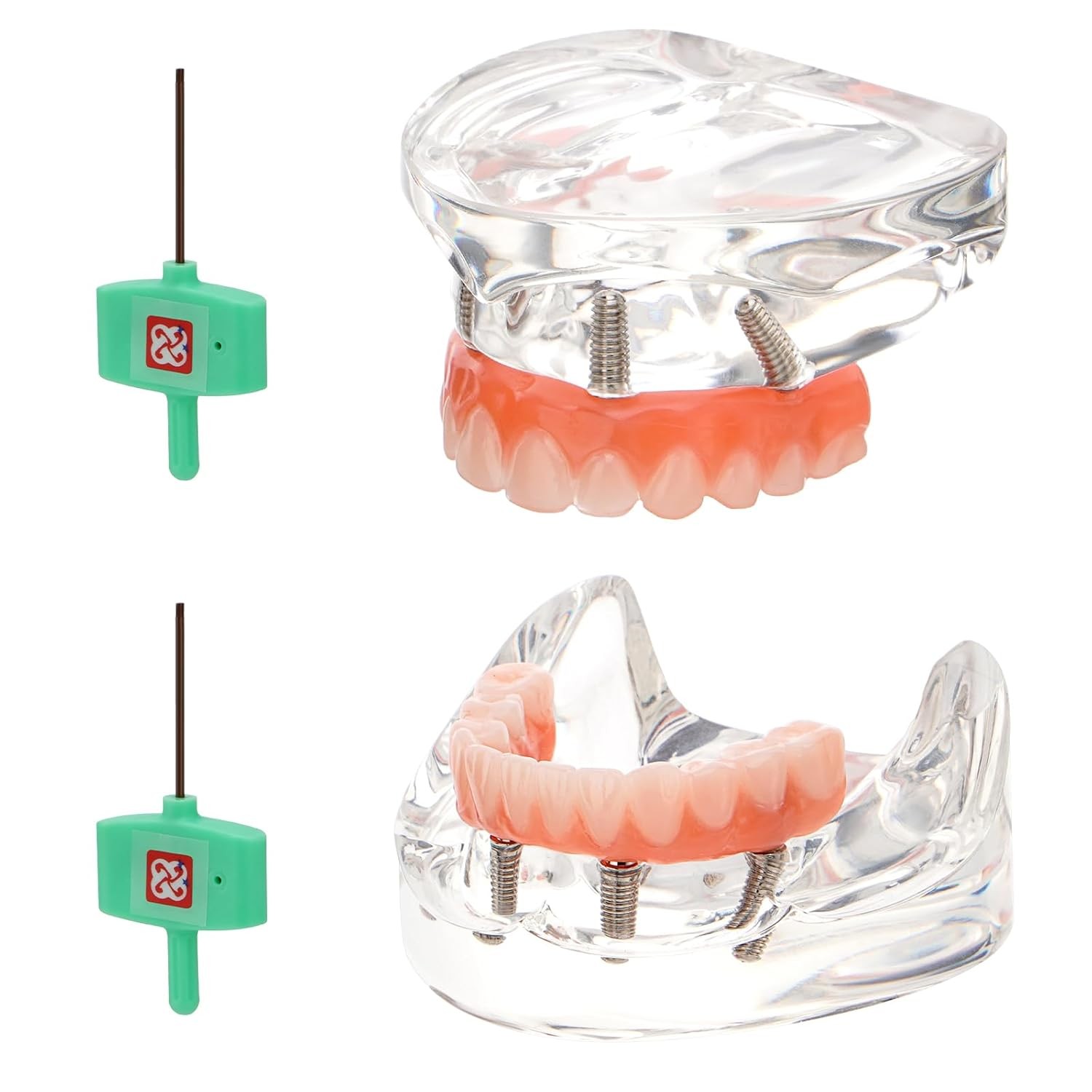 US Dental Implant Model All-on-4 All-on-6 Overdenture U/L Jaw 4/6 Screws Clear