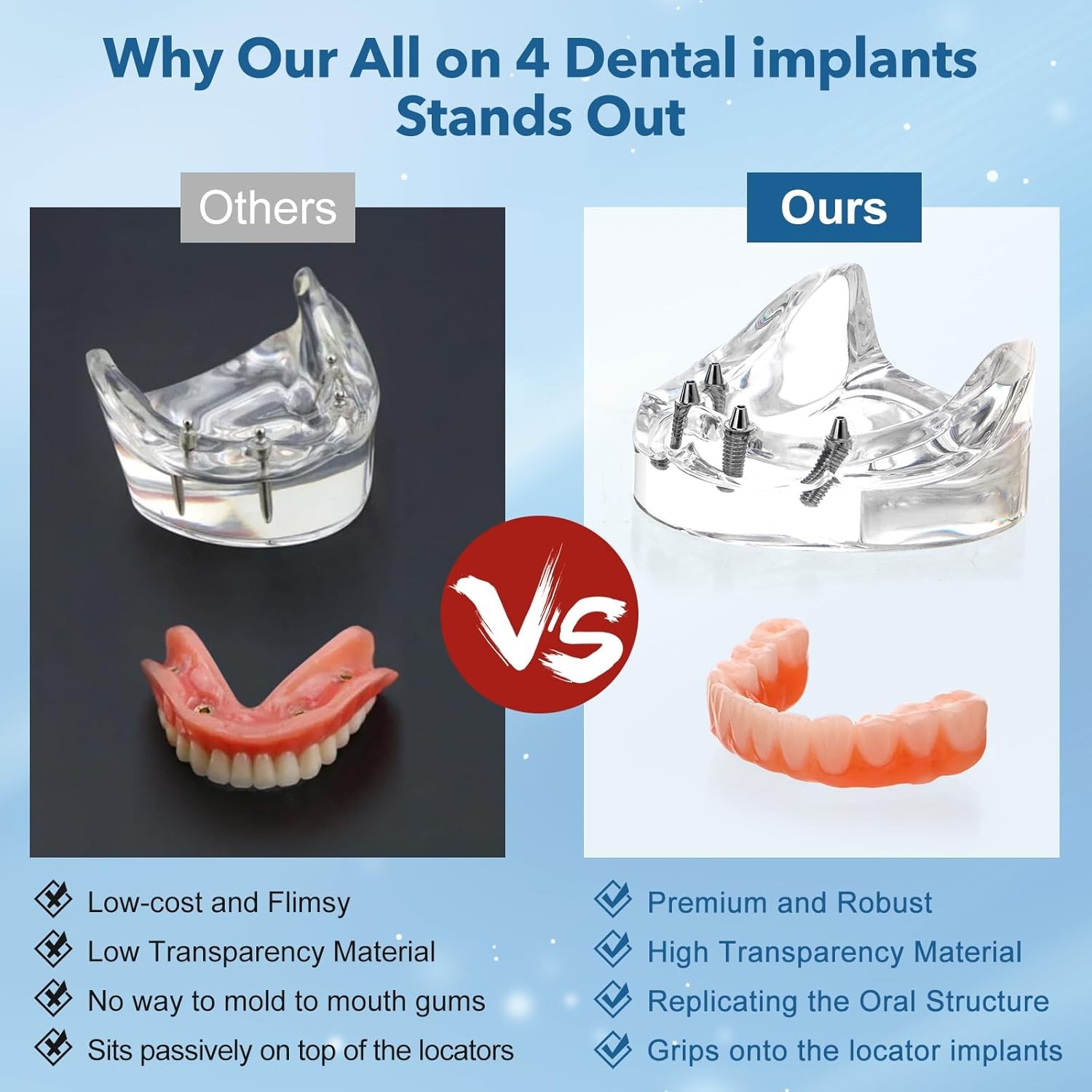 US Dental Implant Model All-on-4 All-on-6 Overdenture U/L Jaw 4/6 Screws Clear