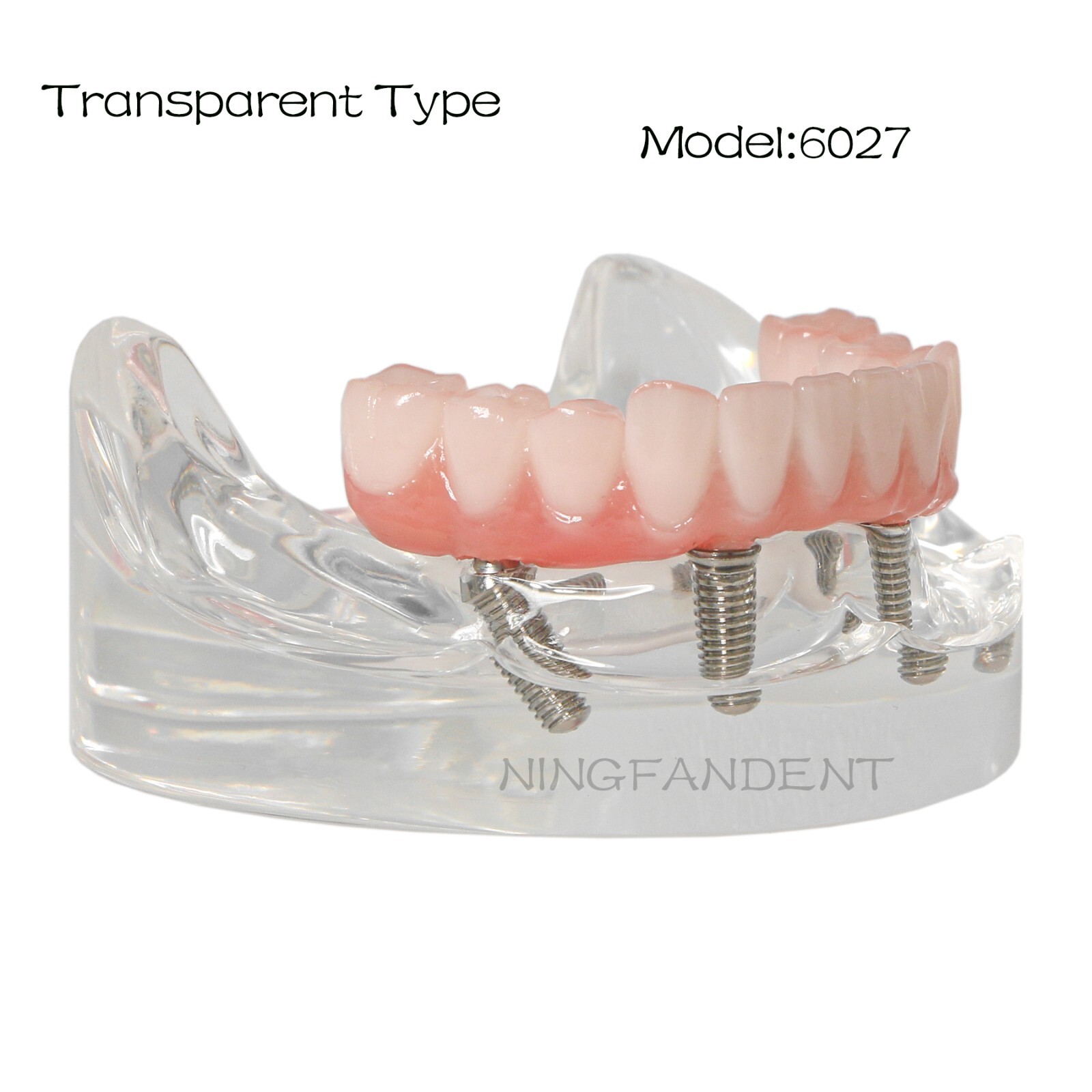 Demo Overdenture All On 4/All On 6 Treatment Dental Implant Model 4/6 Screws Lab