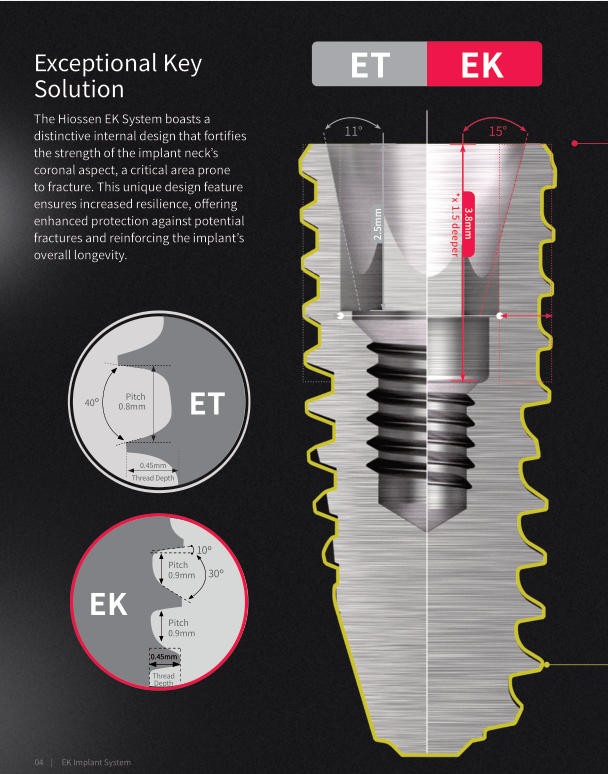Hiossen Dental Locator/Healing/Straight Abutment/17° Angled Transfer Impression
