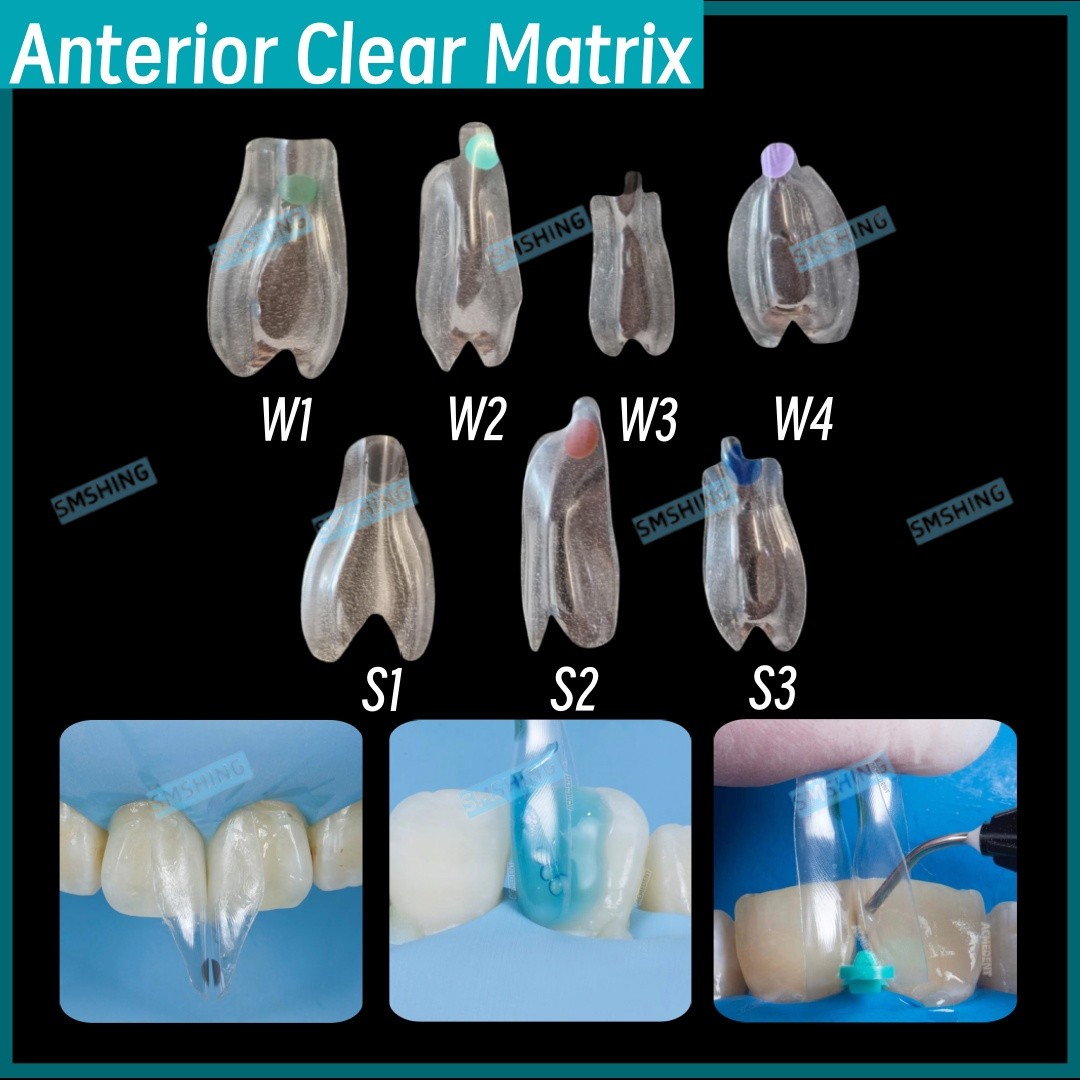 35Pcs Dental Clear Matrix Anterior Matrices BT Bioclear Black Triangle Restore