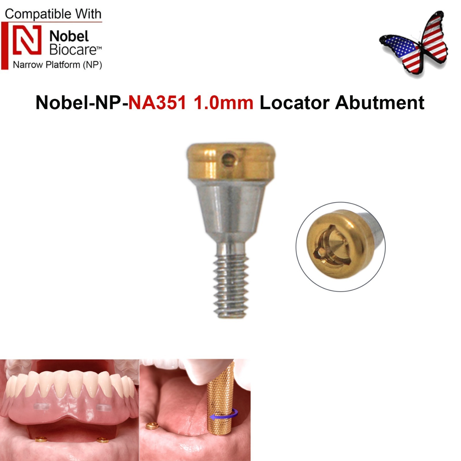 US Dental Locator Attachment Abutment NP/RP Compatible with Nobel Biocare Active