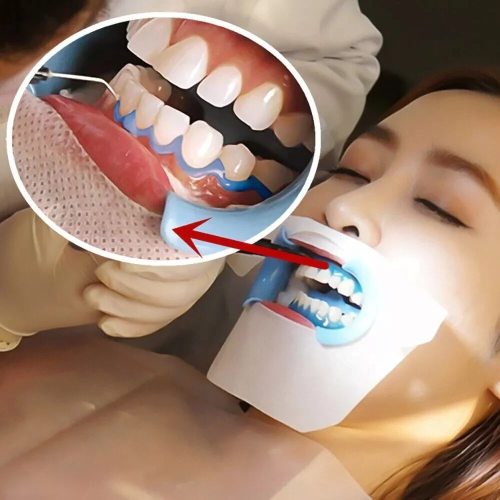 10pcs Dental Gingival Gel Dam Barrier Gum Protector Teeth Whitening 1.5ml/3ml
