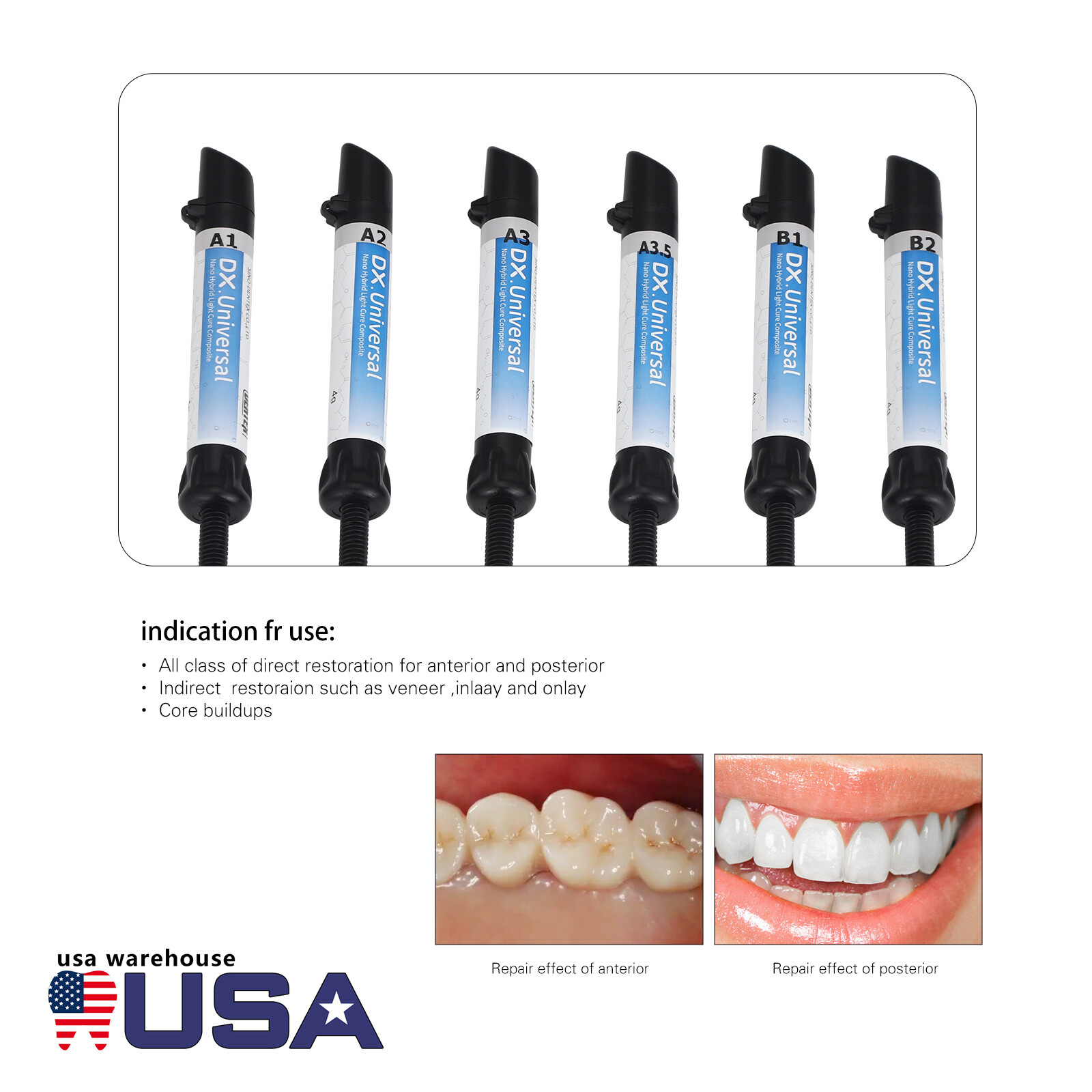 US Dental Universal Light Cure Composite Kit Shade A1 A2 A3 A3.5 B1 B2
