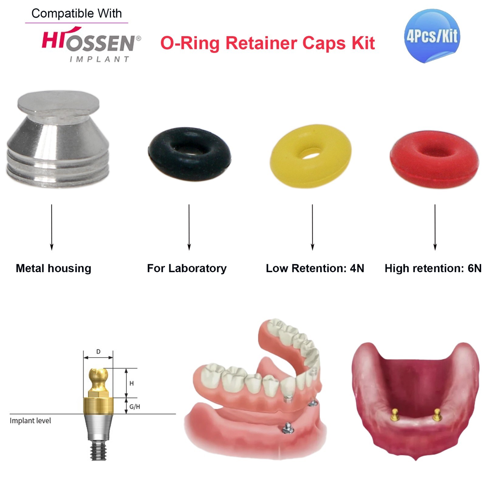 Implant Hiossen/osstem Ball Abutment O-ring Processing Retention Cap For Dental