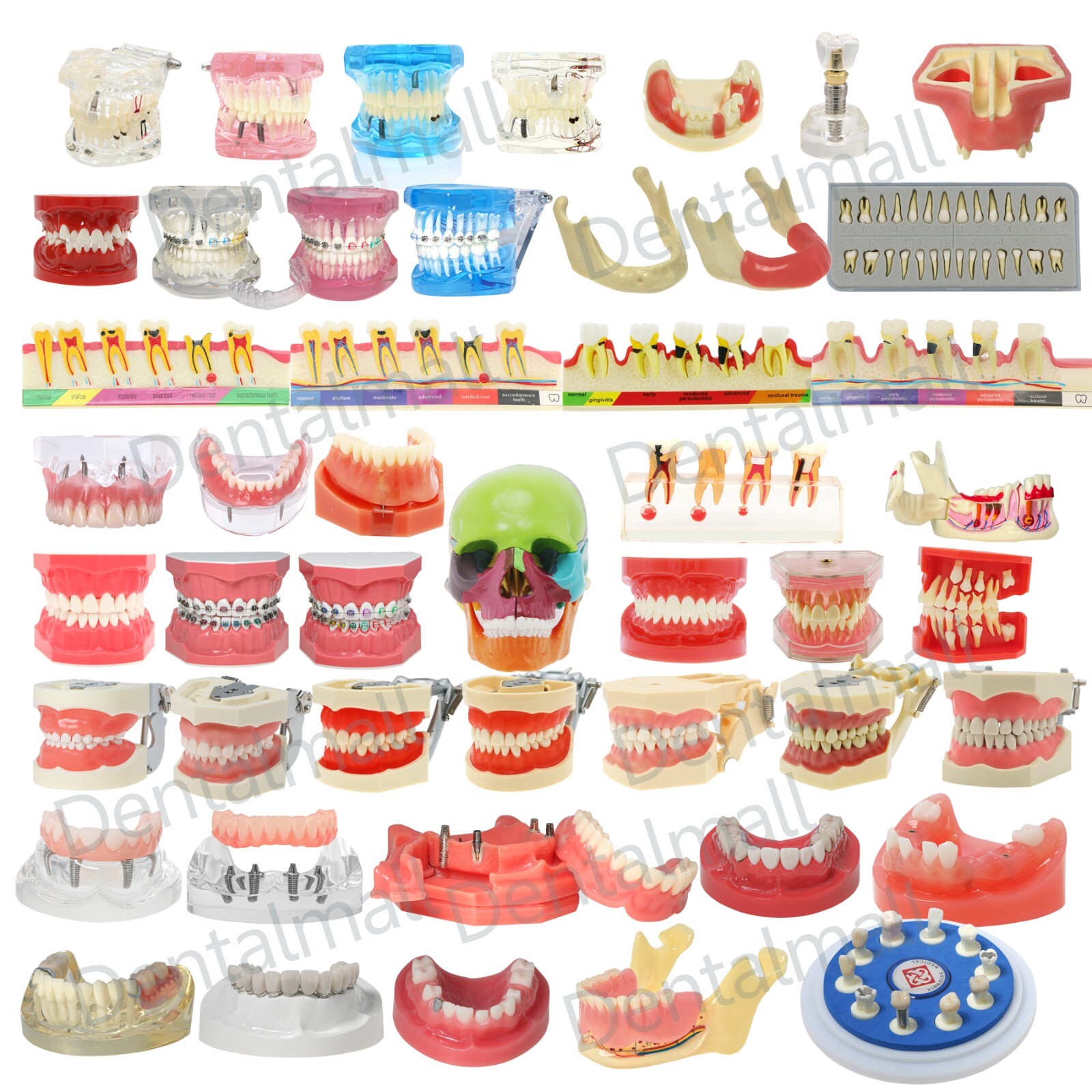Dental Typodont Teeth Model Overdenture Implant Practice Endo Ortho Teachi Study