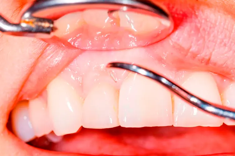 periodontia